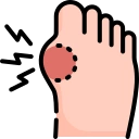 Gout & Uric Acid Management