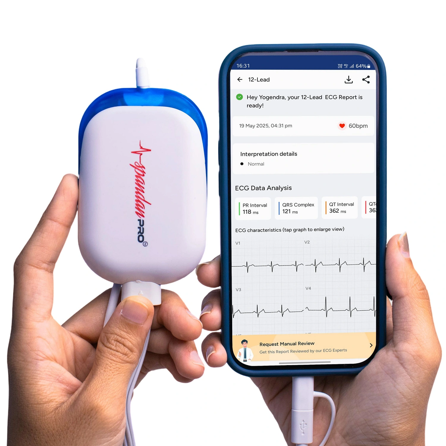 Spandan Pro – Portable 12-Lead ECG for Doctors | 99.7% Accuracy | Trusted Clinical ECG Machine