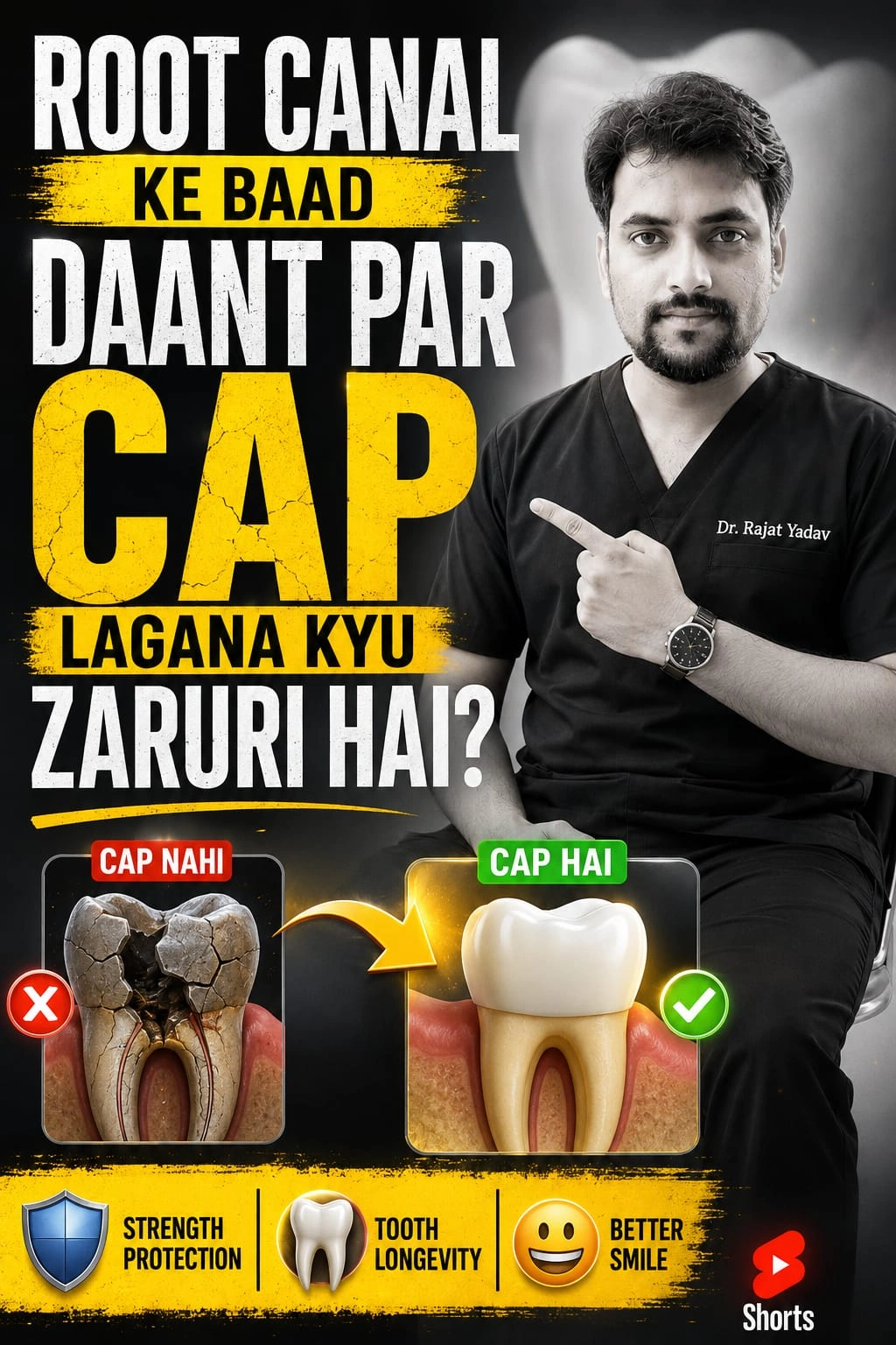 Why You Should get crown on your RCT treated tooth?