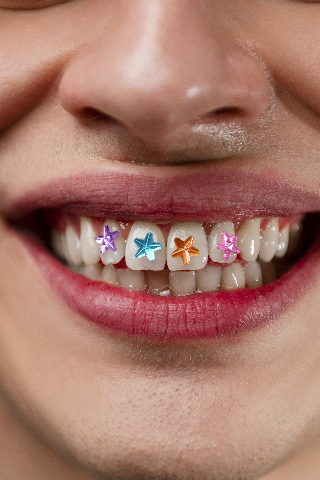 Dental Jewellery
